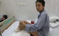 Bỏng điện cao thế, cậu bé 15 tuổi mất một cánh tay và hai cẳng chân