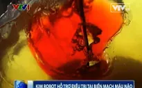 Kim robot hỗ trợ điều trị tai biến mạch máu não