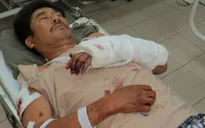 Cán bộ bảo vệ rừng bị lâm tặc tấn công trọng thương
