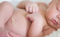 Bệnh lý về rốn trẻ sơ sinh