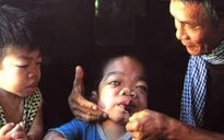 Xây dựng trung tâm bảo trợ nạn nhân da cam lớn nhất miền Bắc