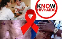 WHO đưa ra hướng dẫn mới phòng ngừa HIV/AIDS