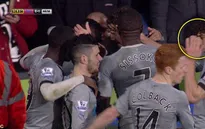"Ăn" đồng xu, thủ quân Newcastle suýt bị mù