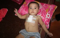 Xót xa cháu bé 2 tuổi mang nhiều căn bệnh quái ác