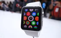 Vì sao Apple Watch được mong chờ?