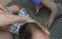 Vụ bé 15 tháng tuổi bị bạo hành: Trách nhiệm thuộc về ai?
