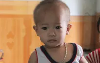 Xót thương bé 18 tháng mắc u 2 thận hiếm gặp