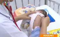 Gia tăng bệnh nhi mắc ho gà