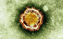 Trung Quốc ghi nhận trường hợp đầu tiên nhiễm MERS