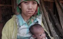 Xót xa hoàn cảnh bé 3 tháng tuổi da bọc xương vì đói sữa