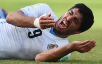 Ngứa răng, Luis Suarez lại cắn?