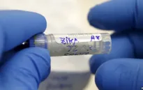 Brazil công bố phương pháp phát hiện virus Zika trong 20 phút