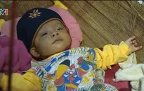 Phép màu đã đến với em bé 24 ngày tuổi mắc tim bẩm sinh