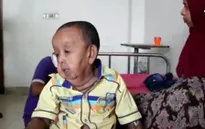 Bangladesh: Điều trị miễn phí cho em bé 4 tuổi như ông lão