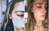 Johnny Depp dùng điện thoại đánh bầm mặt vợ