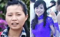 Cô gái sứt môi xinh đẹp bất ngờ tại Change Life - Thay đổi cuộc sống mùa 2