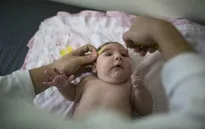 Thêm bằng chứng virus Zika gây chứng đầu nhỏ