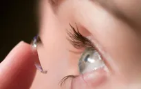 Đeo kính áp tròng cứng có điều trị được cận thị?