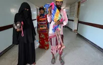 Hơn 14 triệu người Yemen bị thiếu lương thực trầm trọng