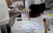Thử nghiệm tích cực, thế giới sắp có vaccine ngừa virus Zika?