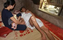 Cha gặp tai nạn, 2 con thơ bị dị tật bẩm sinh rơi vào cảnh đói khát