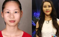 Cô gái bị chàm lột xác trong Change life mùa 2