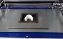 Tự chế niềng răng bằng máy in 3D