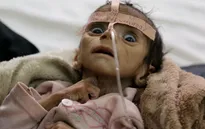 Nỗi ám ảnh phía sau bức ảnh bé trai chết đói tại Yemen