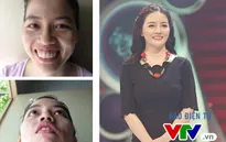 Change Life: Cô gái răng hô bị gia đình bạn trai chối từ "biến hình" thành búp bê
