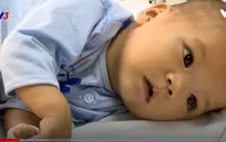 Nỗi đau của em nhỏ 9 tháng tuổi phải trải qua hai lần phẫu thuật tim