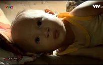 Xót xa em bé vừa bị sứt môi hở hàm ếch vừa bị bệnh tim bẩm sinh