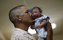 Dị tật đầu nhỏ có thể không phải do virus Zika
