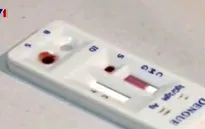 Mỹ thông qua dụng cụ xét nghiệm nhanh virus Zika