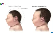 Brazil đầu tư 2,8 triệu USD nghiên cứu virus Zika