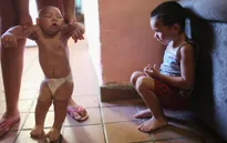 Bộ Y tế cảnh báo virus Zika xuất hiện ở Việt Nam