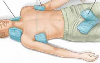 Sốc nhiệt do say nắng: Biểu hiện và cách xử trí