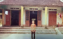 Xót xa bé gái không có bố, bị tim bẩm sinh