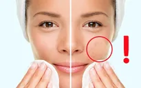 Những lưu ý để có một làn da đẹp hoàn hảo