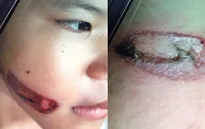 Chưa đến 1 tuần diễn ra 5 vụ bạo hành và sát hại trẻ nhỏ