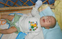 Xót xa bé 3 tháng tuổi phải dùng ống xông sữa để duy trì sự sống