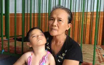 Số phận éo le của cô bé bị tim, câm điếc bẩm sinh, hỏng hai mắt