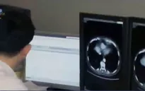 Chữa bệnh bằng trí tuệ nhân tạo