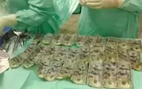 Nuốt 7.000 USD vào bụng vì cãi nhau với chồng