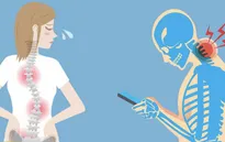 Nguy hiểm tình trạng biến dạng cổ do dùng điện thoại thông minh