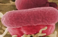Mỹ thu hồi bơ đậu nành nhiễm khuẩn E.coli