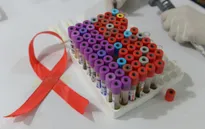 Lây nhiễm HIV/AIDS qua đường tình dục chỉ còn 5% nếu tuân thủ điều này