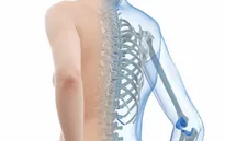 Ô nhiễm không khí có thể gây loãng xương