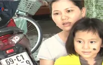 Cà Mau: Cô bé mắc bệnh "người sói" rất cần sự hỗ trợ