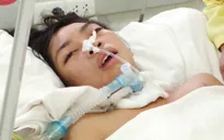 Bị nhiễm uốn ván, tính mạng một nữ sinh lớp 9 nguy kịch