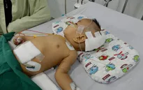 Thương cháu bé 11 tháng tuổi bị não úng thủy